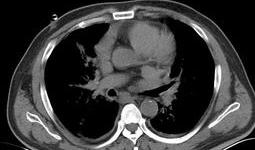 吃瓜爆料17c.ct,吃瓜爆料背后的真相与内幕